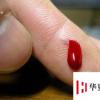 生活小知識：刀割到手怎樣處理