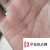 生活小知識：頭發能不能扎進肉里？