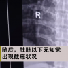90后男子做俯臥撐致下身癱瘓