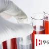 生活小知識：如何判斷孩子的血型 根據父母血型推斷孩子血型