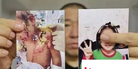 撫順6歲被虐女童父親望嚴懲前妻