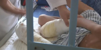 7歲男童滿身煙頭燙傷疤痕雙手面臨截肢