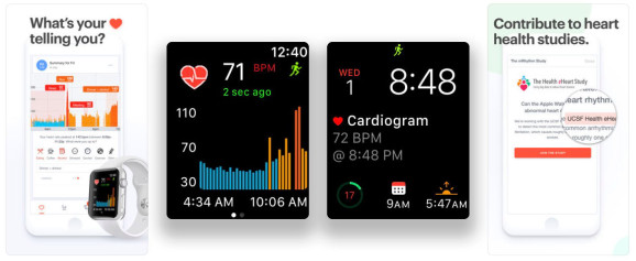 Apple Watch心電圖應用程序擊敗EKG樂隊發現錯誤的心跳