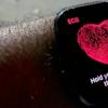蘋果與強生公司共同研究Apple Watch應用程序是否可降低中風風險