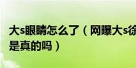 大s眼睛怎么了(網曝大s徐熙媛眼睛動過刀子是真的嗎)