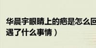 華晨宇眼睛上的疤是怎么回事(起底華晨宇遭遇了什么事情)
