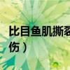 比目魚肌撕裂很嚴重嗎（比目魚肌為什么會受傷）