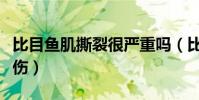 比目魚肌撕裂很嚴重嗎(比目魚肌為什么會受傷)