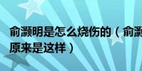 俞灝明是怎么燒傷的(俞灝明英雄救美的真相原來是這樣)
