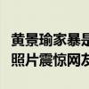 黃景瑜家暴是怎么回事（網上流出黃景瑜家暴照片震驚網友）