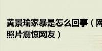 黃景瑜家暴是怎么回事(網上流出黃景瑜家暴照片震驚網友)