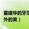霍建華的牙怎么了（剪了光頭的他牙齒顯得格外的黃）