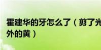 霍建華的牙怎么了(剪了光頭的他牙齒顯得格外的黃)