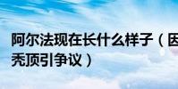 阿爾法現在長什么樣子(因為熬夜而導致年少禿頂引爭議)