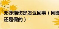 鄧莎燒傷是怎么回事(網曝鄧莎被毀容是真的還是假的)
