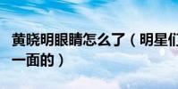 黃曉明眼睛怎么了(明星們不僅僅只又光鮮的一面的)