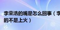 李榮浩的嘴是怎么回事(李榮浩自曝車禍造成的不是上火)
