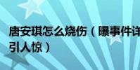 唐安琪怎么燒傷(曝事件詳情及其被燒傷照片引人驚)