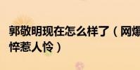 郭敬明現在怎么樣了(網爆郭敬明近照狀態憔悴惹人憐)