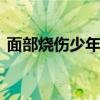 面部燒傷少年戴面具賣櫻桃 具體是怎么回事