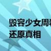 毀容少女周巖照片 少女周巖毀容的事情始末還原真相