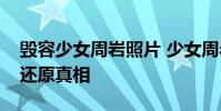 毀容少女周巖照片 少女周巖毀容的事情始末還原真相