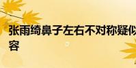 張雨綺鼻子左右不對稱疑似整容張雨綺回應整容