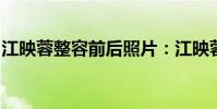 江映蓉整容前后照片:江映蓉減肥前后對比照