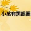 小孩有黑眼圈怎么辦（三個辦法介紹給大家）
