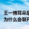 王一博耳朵是什么時候受的傷（王一博的耳垂為什么會裂開）