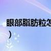 眼部脂肪粒怎么去除（怎么才是最有效的辦法）