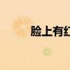 臉上有紅血絲怎么辦（如何治療）