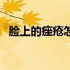 臉上的痤瘡怎么辦（臉上痤瘡的治療方法）