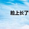 臉上長了青春痘怎么治（你知道嗎）