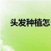 頭發種植怎么樣（頭發種植的效果咋樣）