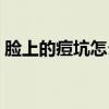 臉上的痘坑怎么去掉（怎么預防臉上長痘痘）