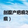 剖腹產疤痕怎么消除（四招有效去除剖腹產疤痕）