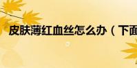 皮膚薄紅血絲怎么辦(下面提供幾種方法)