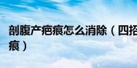 剖腹產疤痕怎么消除(四招有效去除剖腹產疤痕)