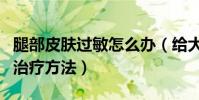 腿部皮膚過敏怎么辦(給大家介紹一些基本的治療方法)