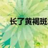 長了黃褐斑怎么辦（治療方法總結如下）