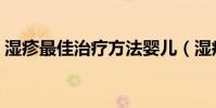 濕疹最佳治療方法嬰兒(濕疹最佳治療方法)