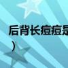 后背長痘痘是什么原因怎么治療（后背長痘痘）