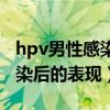 hpv男性感染后有多大幾率治愈（hpv男性感染后的表現）