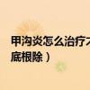 甲溝炎怎么治療才能徹底根除知乎（甲溝炎怎么治療才能徹底根除）