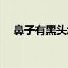 鼻子有黑頭怎么辦（鼻子有黑頭怎么辦）