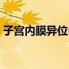 子宮內膜異位會有什么危害（子宮內膜移位）