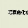 毛囊角化癥（關于毛囊角化癥的介紹）