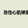 急性心肌梗塞（關于急性心肌梗塞的介紹）