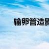輸卵管造影（關于輸卵管造影的介紹）